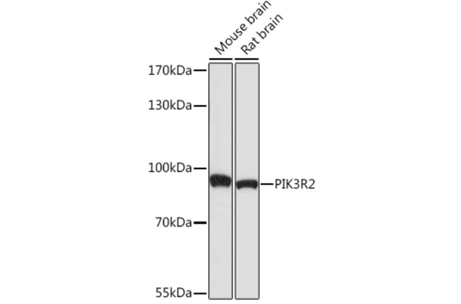 Western Blot - Anti-PI 3 Kinase p85 beta Antibody (A87727) - Antibodies.com