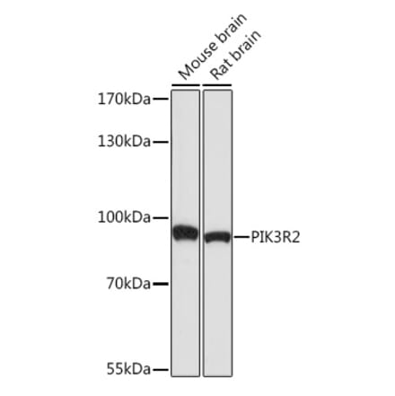 Western Blot - Anti-PI 3 Kinase p85 beta Antibody (A87727) - Antibodies.com