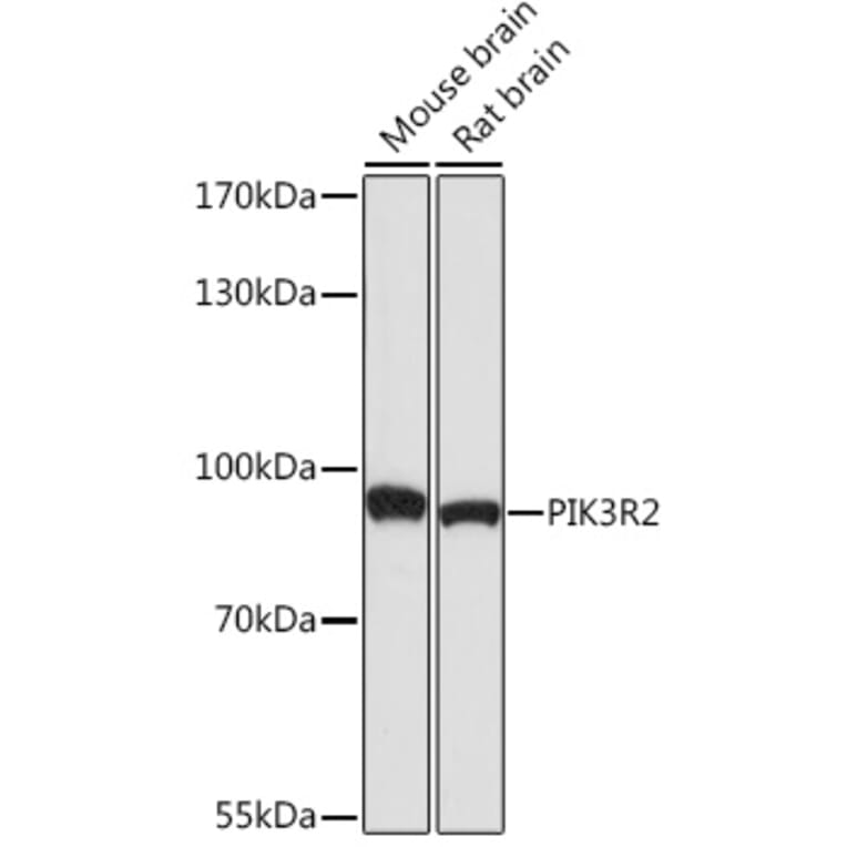 Western Blot - Anti-PI 3 Kinase p85 beta Antibody (A87727) - Antibodies.com