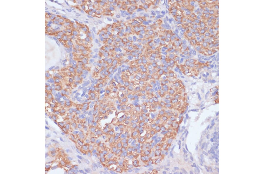 Immunohistochemistry - Anti-PI 3 Kinase p85 beta Antibody (A87727) - Antibodies.com
