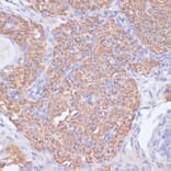 Immunohistochemistry - Anti-PI 3 Kinase p85 beta Antibody (A87727) - Antibodies.com