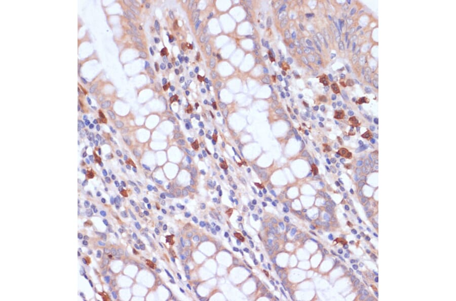 Immunohistochemistry - Anti-PI 3 Kinase p85 beta Antibody (A87727) - Antibodies.com