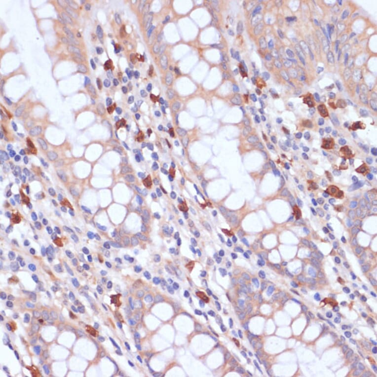 Immunohistochemistry - Anti-PI 3 Kinase p85 beta Antibody (A87727) - Antibodies.com