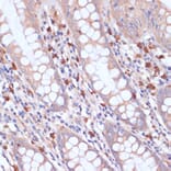 Immunohistochemistry - Anti-PI 3 Kinase p85 beta Antibody (A87727) - Antibodies.com