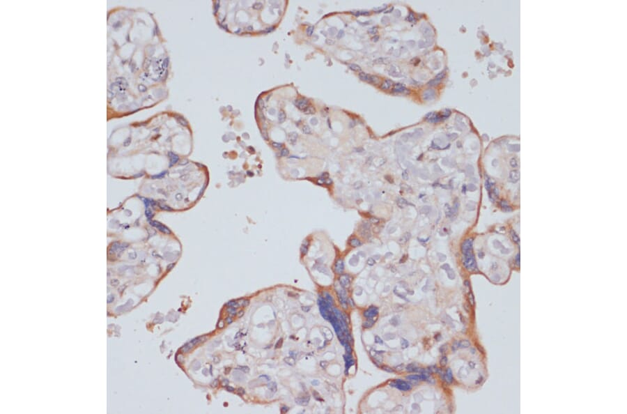 Immunohistochemistry - Anti-PI 3 Kinase p85 beta Antibody (A87727) - Antibodies.com