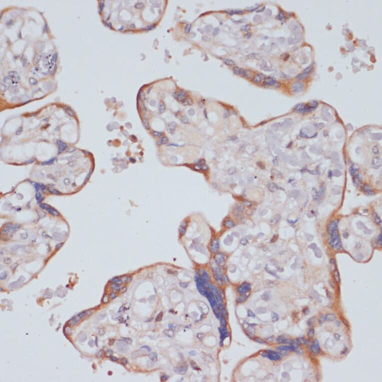 Immunohistochemistry - Anti-PI 3 Kinase p85 beta Antibody (A87727) - Antibodies.com