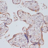 Immunohistochemistry - Anti-PI 3 Kinase p85 beta Antibody (A87727) - Antibodies.com