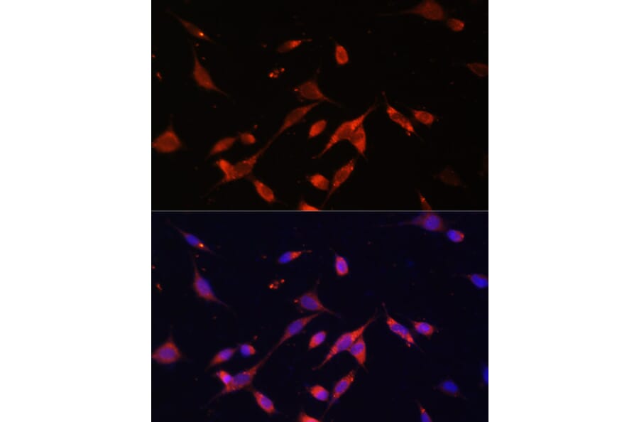 Immunofluorescence - Anti-PI 3 Kinase p85 beta Antibody (A87727) - Antibodies.com