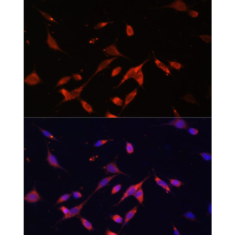 Immunofluorescence - Anti-PI 3 Kinase p85 beta Antibody (A87727) - Antibodies.com