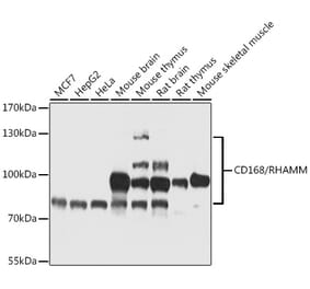 Western Blot - Anti-CD168 Antibody (A87728) - Antibodies.com
