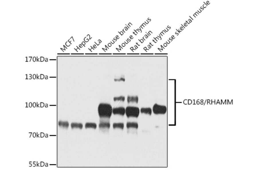 Western Blot - Anti-CD168 Antibody (A87728) - Antibodies.com