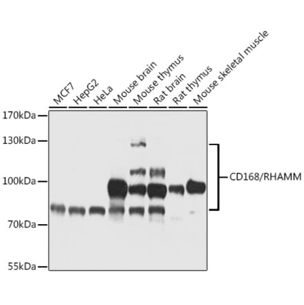 Western Blot - Anti-CD168 Antibody (A87728) - Antibodies.com