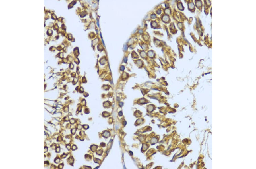 Immunohistochemistry - Anti-Hsp90 alpha Antibody (A87729) - Antibodies.com