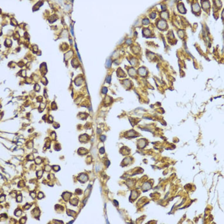 Immunohistochemistry - Anti-Hsp90 alpha Antibody (A87729) - Antibodies.com
