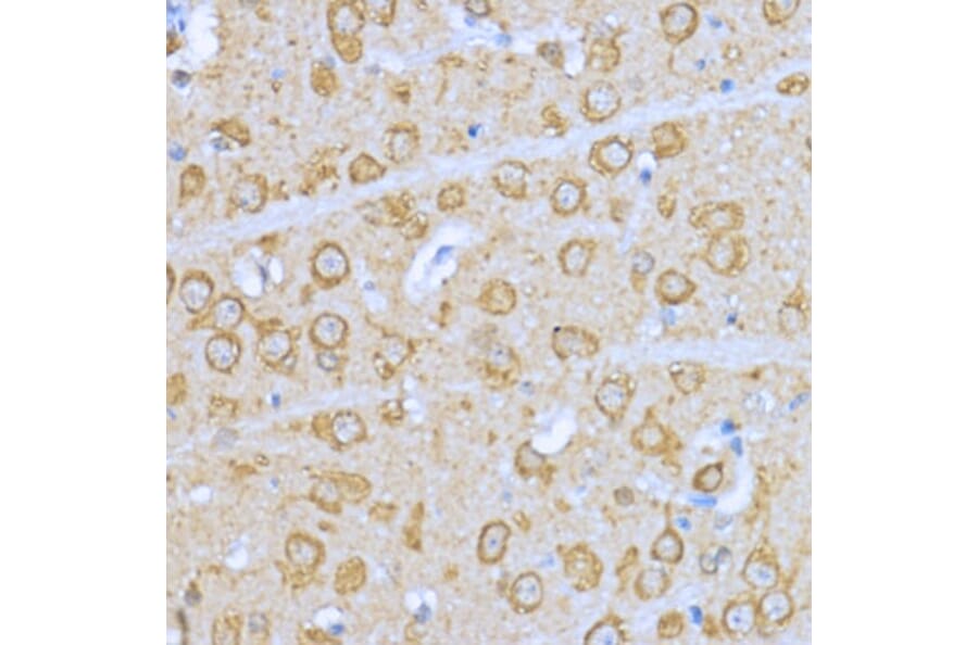 Immunohistochemistry - Anti-Hsp90 alpha Antibody (A87729) - Antibodies.com