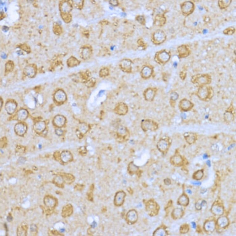 Immunohistochemistry - Anti-Hsp90 alpha Antibody (A87729) - Antibodies.com