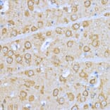 Immunohistochemistry - Anti-Hsp90 alpha Antibody (A87729) - Antibodies.com