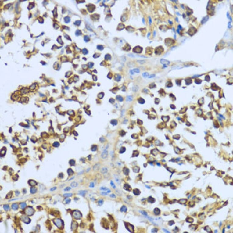 Immunohistochemistry - Anti-Hsp90 alpha Antibody (A87729) - Antibodies.com
