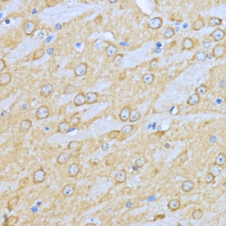 Immunohistochemistry - Anti-Hsp90 alpha Antibody (A87729) - Antibodies.com