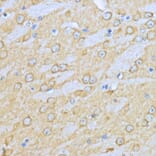 Immunohistochemistry - Anti-Hsp90 alpha Antibody (A87729) - Antibodies.com