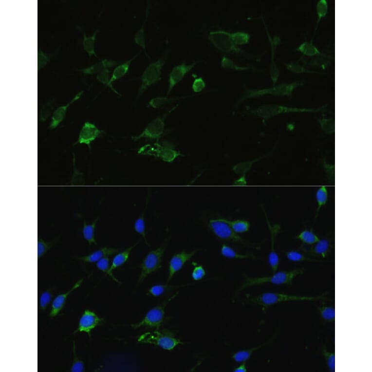 Immunofluorescence - Anti-Hsp90 alpha Antibody (A87729) - Antibodies.com