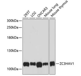 Western Blot - Anti-Zinc finger antiviral protein Antibody (A87730) - Antibodies.com