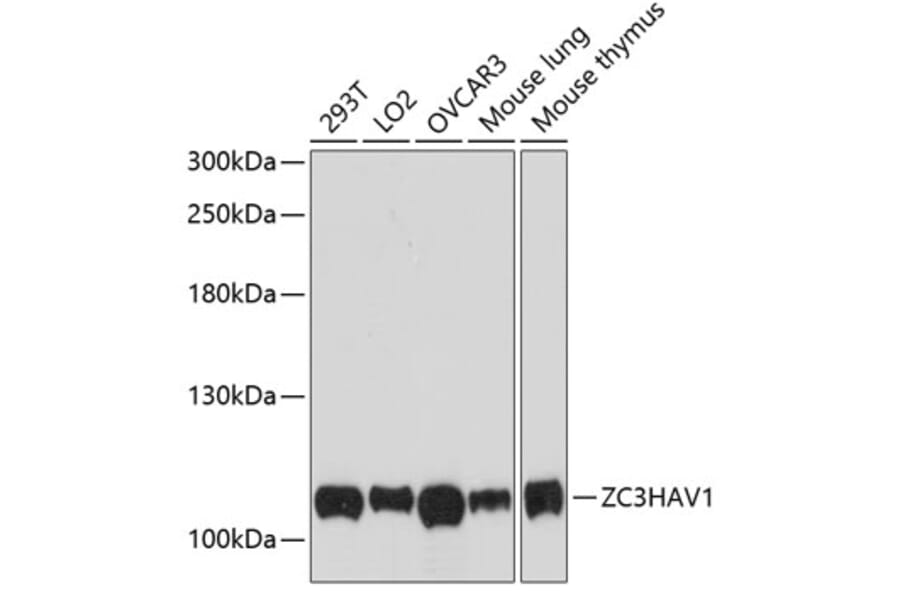 Western Blot - Anti-Zinc finger antiviral protein Antibody (A87730) - Antibodies.com