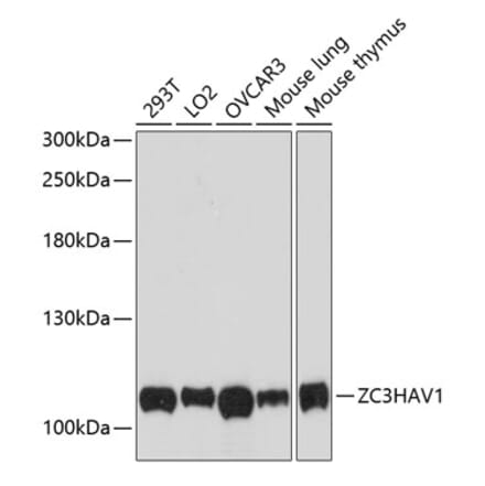 Western Blot - Anti-Zinc finger antiviral protein Antibody (A87730) - Antibodies.com