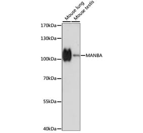 Western Blot - Anti-MANBA Antibody (A87731) - Antibodies.com