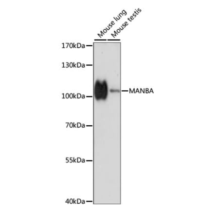 Western Blot - Anti-MANBA Antibody (A87731) - Antibodies.com