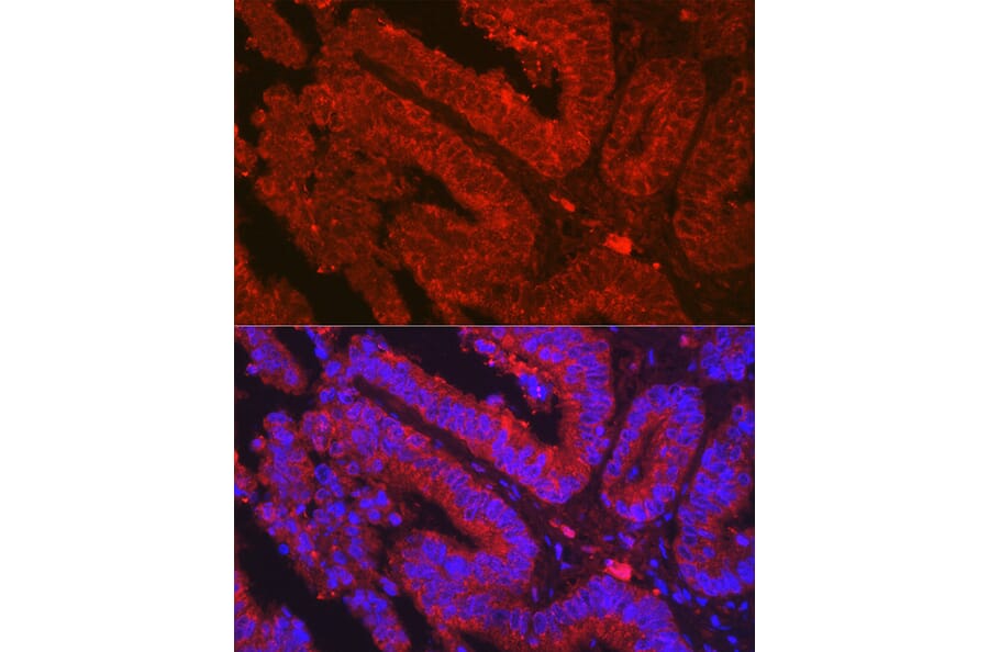 Immunofluorescence - Anti-OLFM4 Antibody (A87732) - Antibodies.com