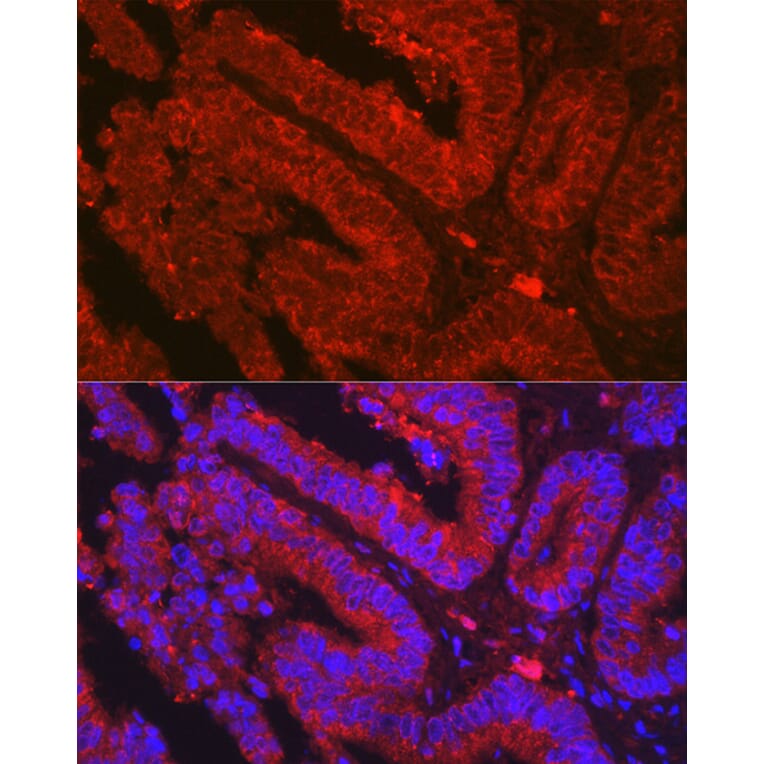 Immunofluorescence - Anti-OLFM4 Antibody (A87732) - Antibodies.com