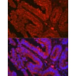 Immunofluorescence - Anti-OLFM4 Antibody (A87732) - Antibodies.com