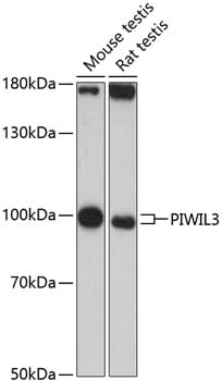 Western blot analysis of extracts of various cell lines, using Anti-PIWIL3 Antibody (A13203) at 1:3000 dilution.
Secondary antibody: Goat Anti-Rabbit IgG (H+L) (HRP) (AS014) at 1:10,000 dilution.
Lysates / proteins: 25µg per lane.
Blocking buffer: 3% non-fat dry milk in TBST.
Detection: ECL Basic Kit (RM00020).
Exposure time: 90s.