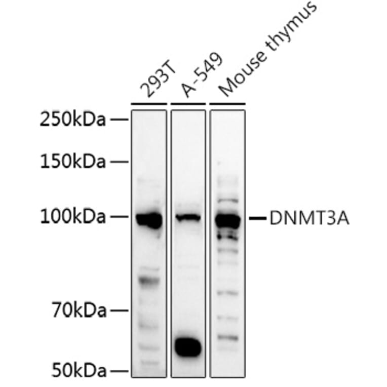 Western Blot - Anti-Dnmt3a Antibody (A87735) - Antibodies.com