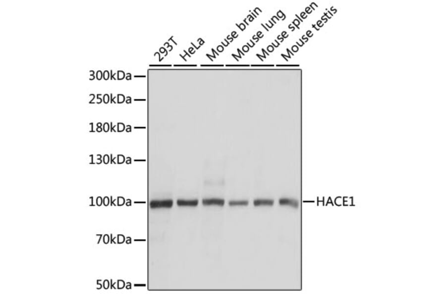 Western Blot - Anti-HACE1 Antibody (A87736) - Antibodies.com