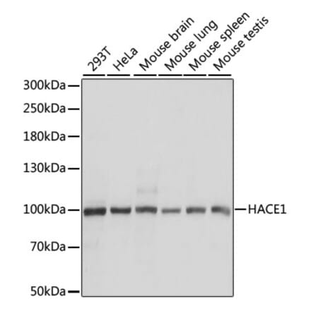 Western Blot - Anti-HACE1 Antibody (A87736) - Antibodies.com