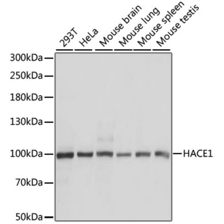 Western Blot - Anti-HACE1 Antibody (A87736) - Antibodies.com