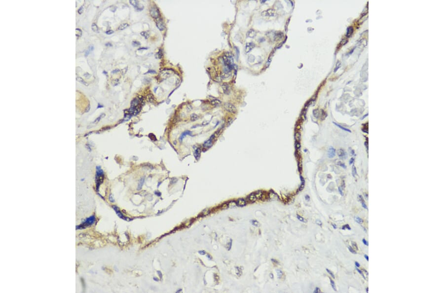 Immunohistochemistry - Anti-HACE1 Antibody (A87736) - Antibodies.com