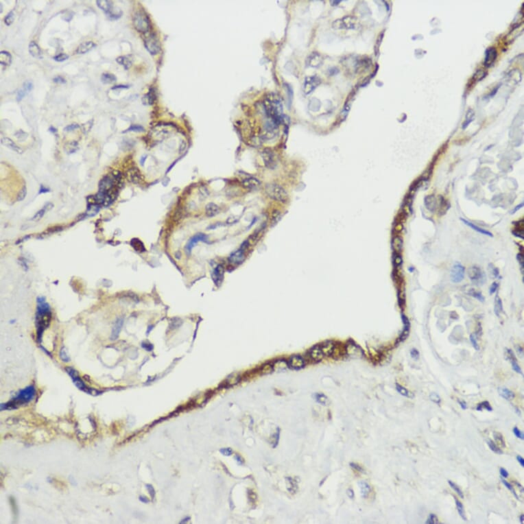 Immunohistochemistry - Anti-HACE1 Antibody (A87736) - Antibodies.com
