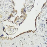 Immunohistochemistry - Anti-HACE1 Antibody (A87736) - Antibodies.com