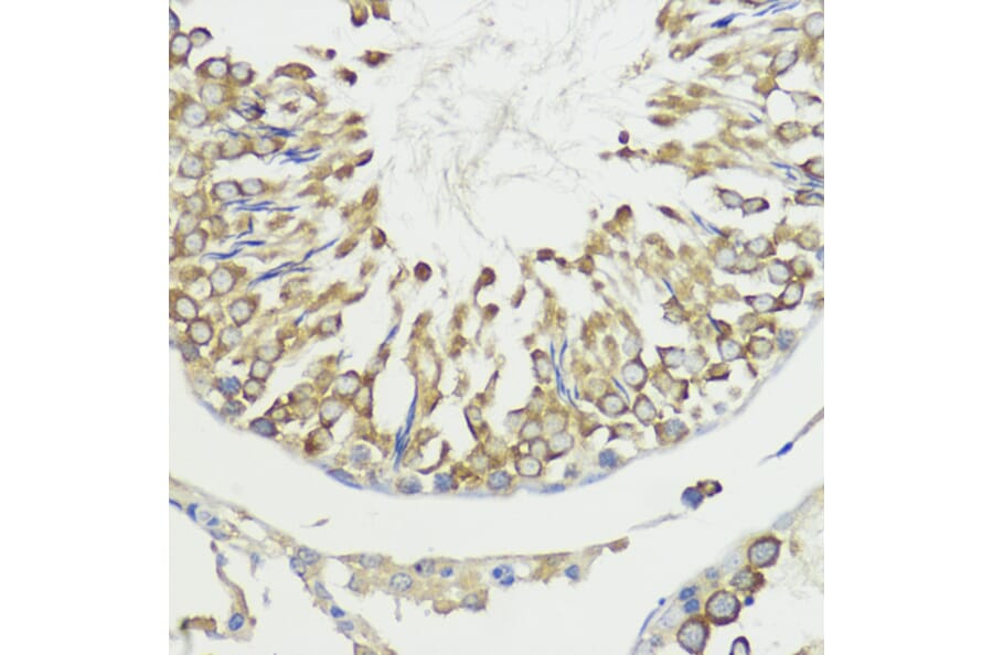 Immunohistochemistry - Anti-HACE1 Antibody (A87736) - Antibodies.com