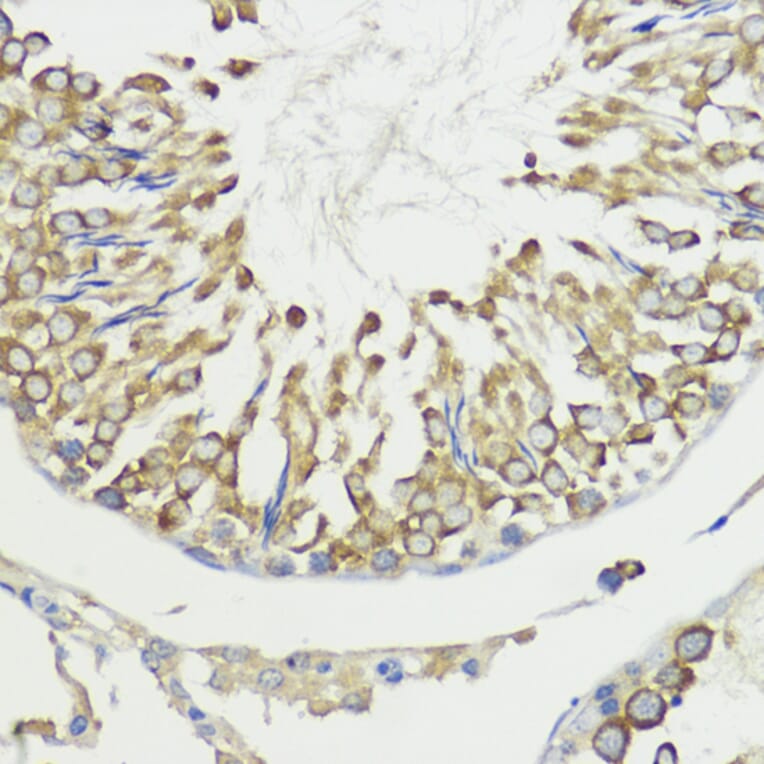Immunohistochemistry - Anti-HACE1 Antibody (A87736) - Antibodies.com