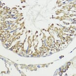 Immunohistochemistry - Anti-HACE1 Antibody (A87736) - Antibodies.com