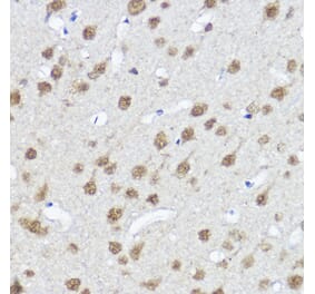 Immunohistochemistry - Anti-MYOCD Antibody (A87737) - Antibodies.com