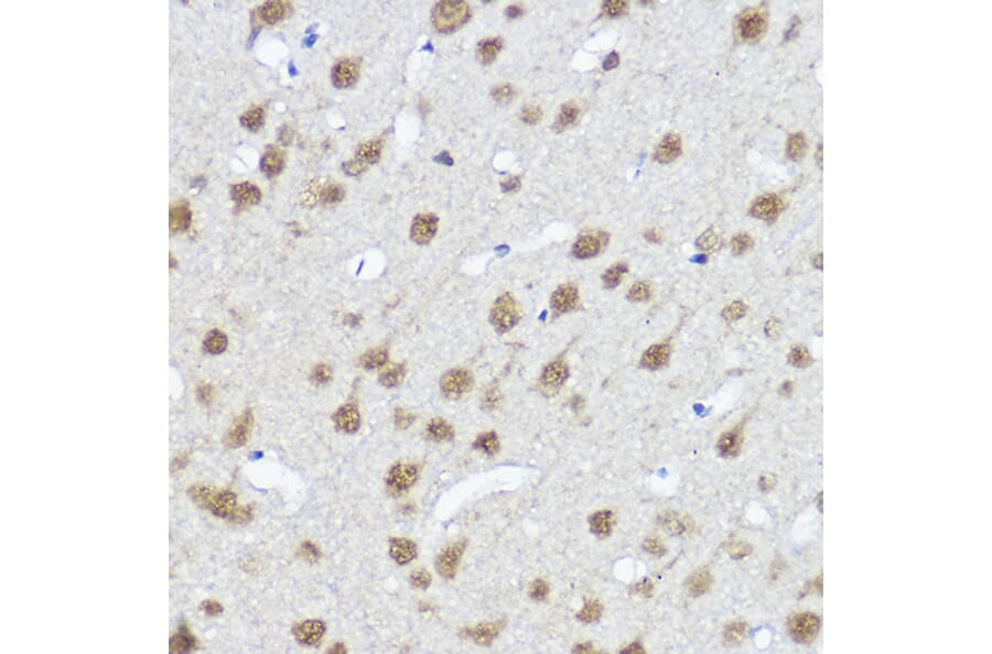 Immunohistochemistry - Anti-MYOCD Antibody (A87737) - Antibodies.com