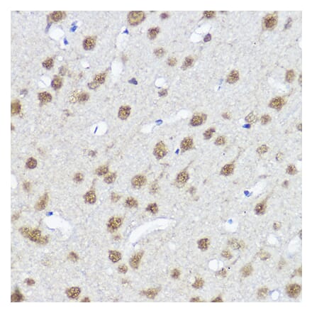 Immunohistochemistry - Anti-MYOCD Antibody (A87737) - Antibodies.com