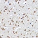 Immunohistochemistry - Anti-MYOCD Antibody (A87737) - Antibodies.com