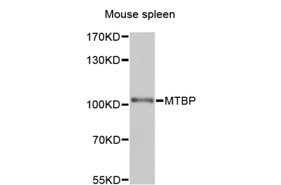 Western Blot - Anti-MTBP Antibody (A12363) - Antibodies.com
