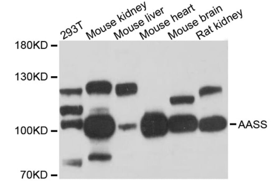 Western Blot - Anti-AASS Antibody (A12863) - Antibodies.com
